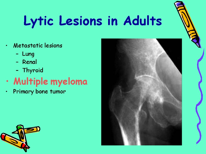 Metastatic lesions Lung Renal Thyroid Multiple myeloma Primary bone tumor Lytic Lesions in Adults